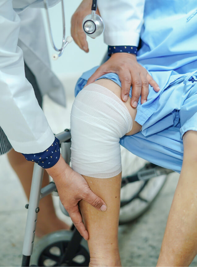 Leg injury photo.